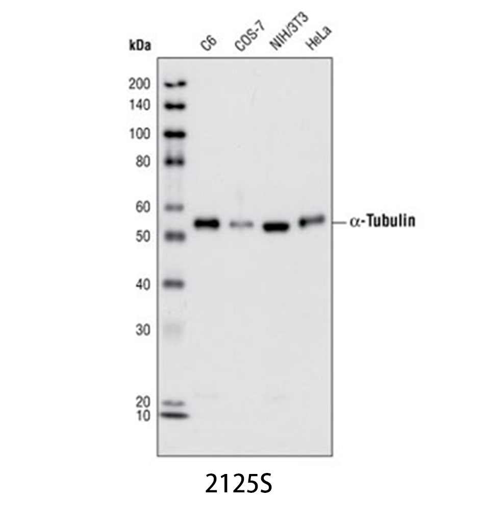α-Tubulin (11H10) Rabbit mAb