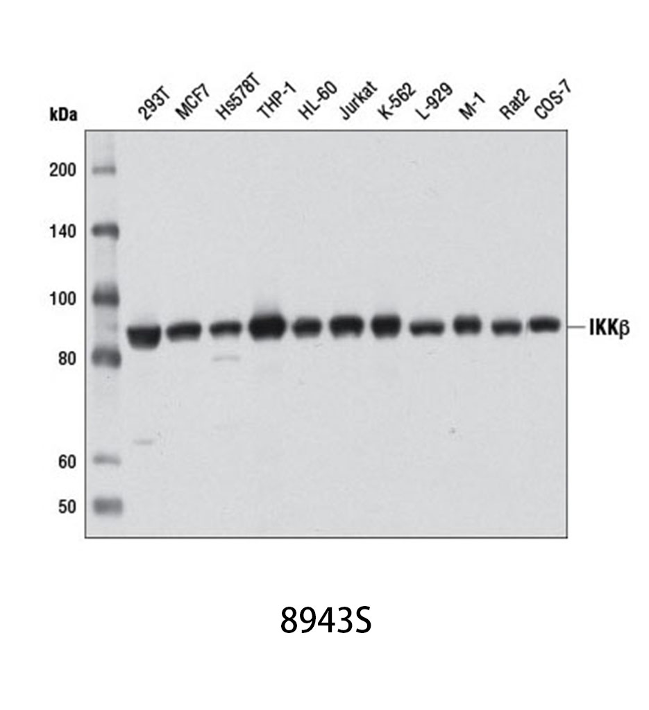 IKKβ (D30C6) Rabbit mAb
