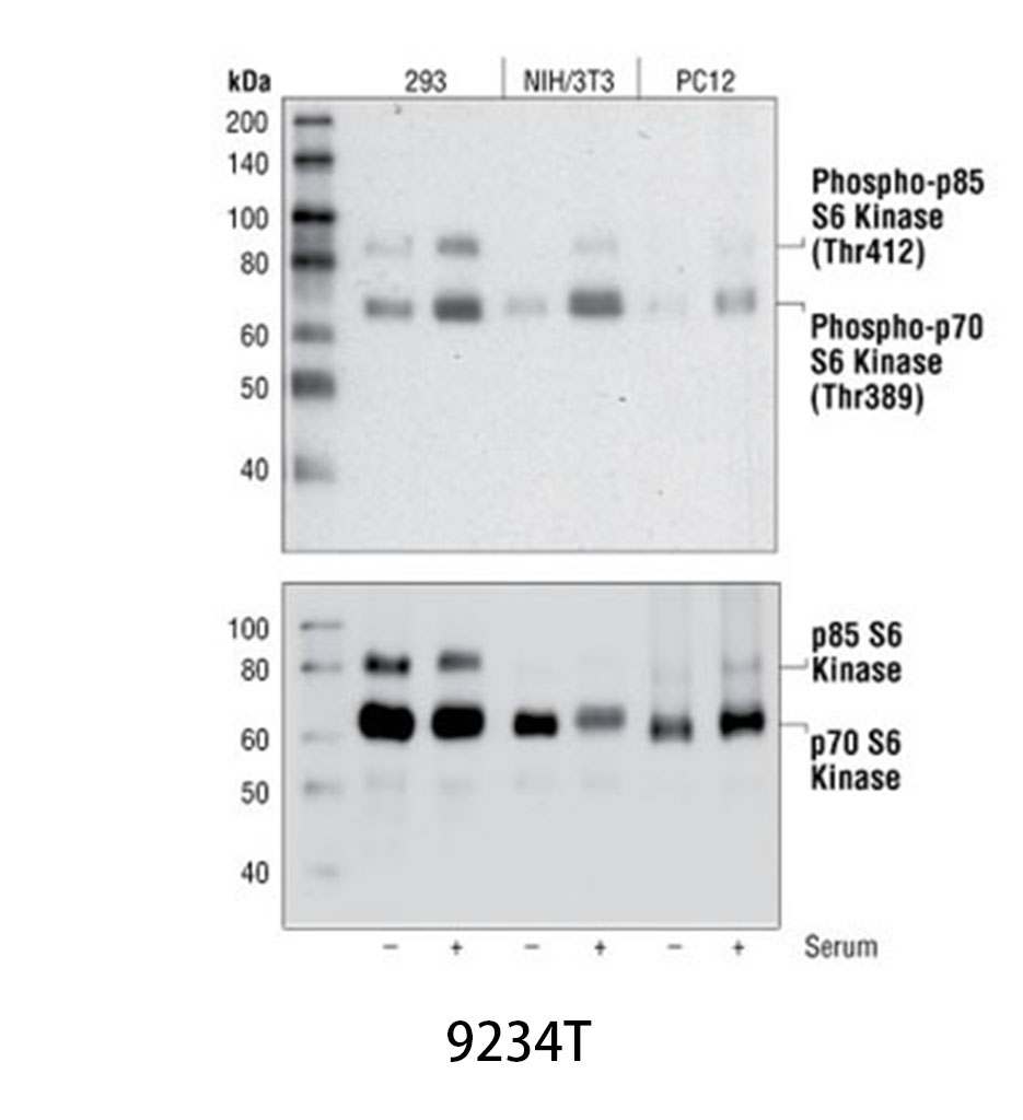 Phospho-p70 S6 Kinase (Thr389) (108D2) Rabbit mAb