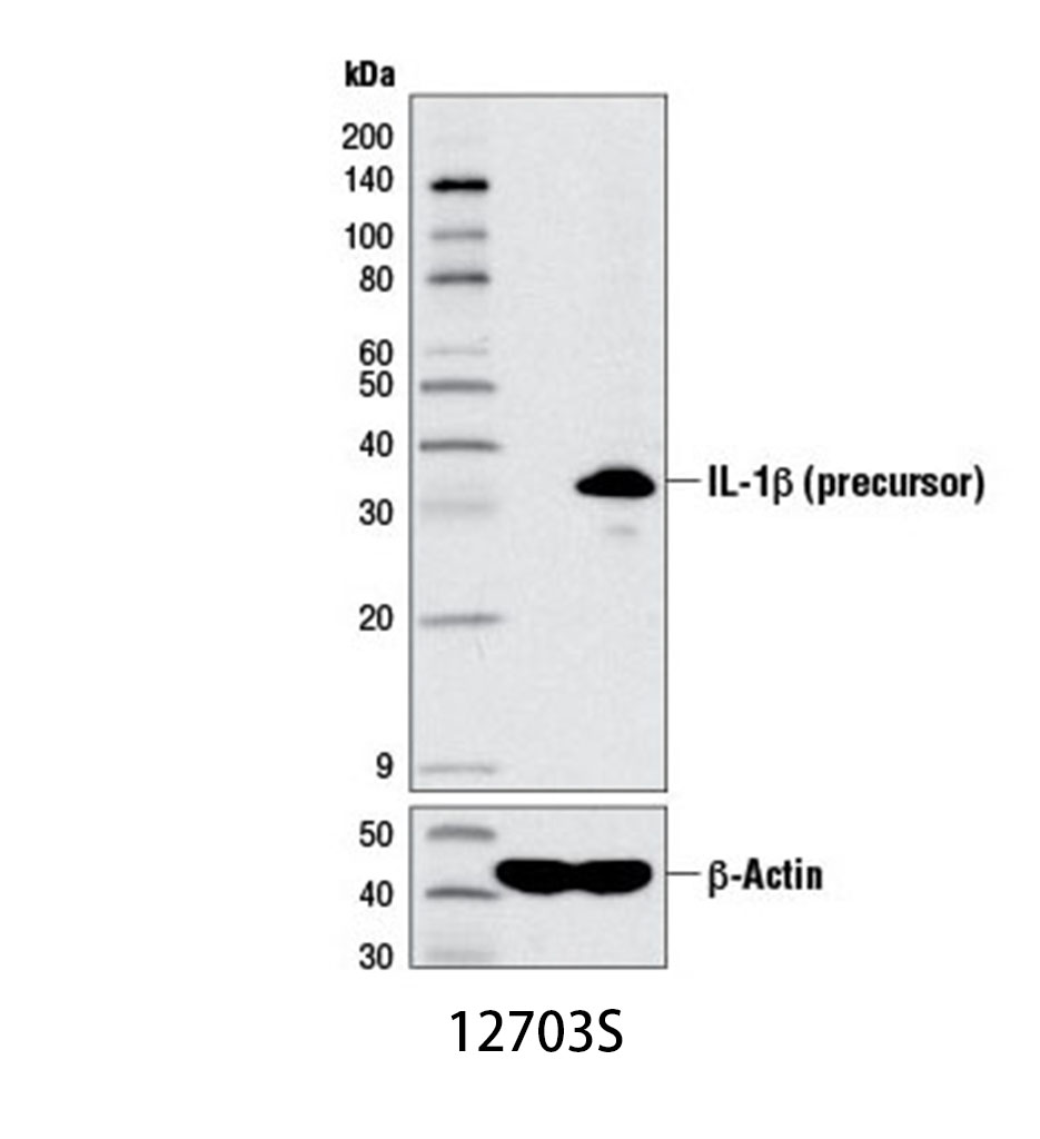 IL-1β (D3U3E) Rabbit mAb