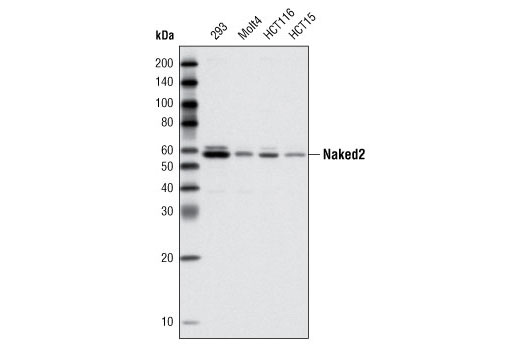 Wnt Signaling Antibody Sampler Kit