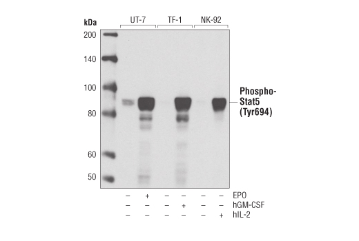 Phospho-Stat5 (Tyr694) (D47E7) XP Rabbit mAb
