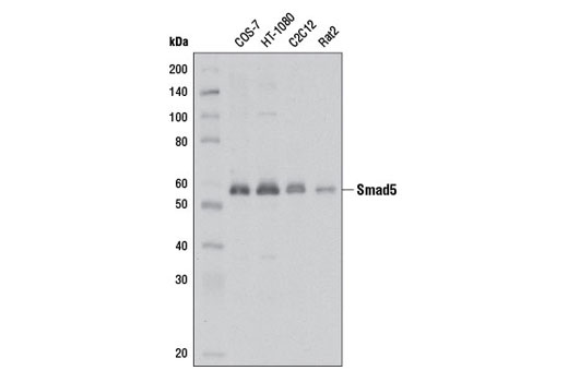 Smad 1/5/9 Antibody Sampler Kit