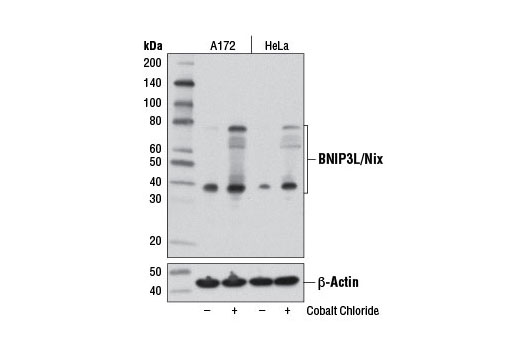 BNIP3L/Nix (D4R4B) Rabbit mAb