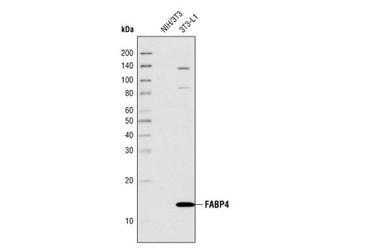 Adipogenesis Marker Antibody Sampler Kit