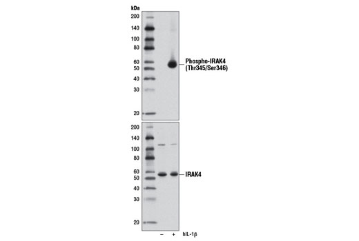 Phospho-IRAK4 (Thr345/Ser346) (D6D7) Rabbit mAb