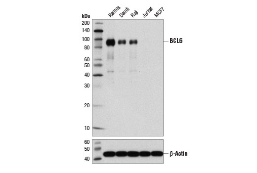 BCL6 (D4I2V) XP Rabbit mAb