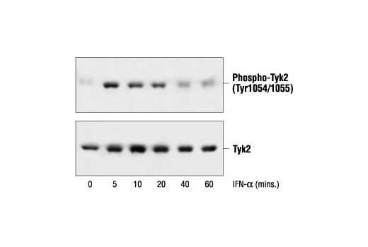Phospho-Tyk2 (Tyr1054/1055) Antibody