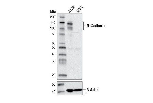 Cadherin-Catenin Antibody Sampler Kit