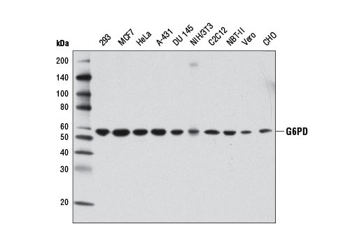 G6PD (D5D2) Rabbit mAb