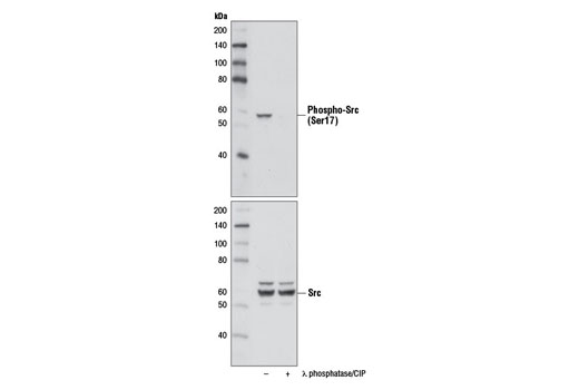 Phospho-Src (Ser17) (D7F2Q) Rabbit mAb