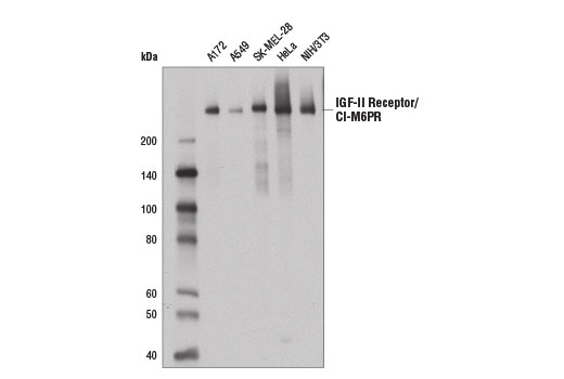 IGF-II Receptor/CI-M6PR (D3V8C) Rabbit mAb