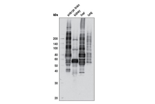 Phospho-(Ser/Thr) Kinase Substrate Antibody Sampler Kit