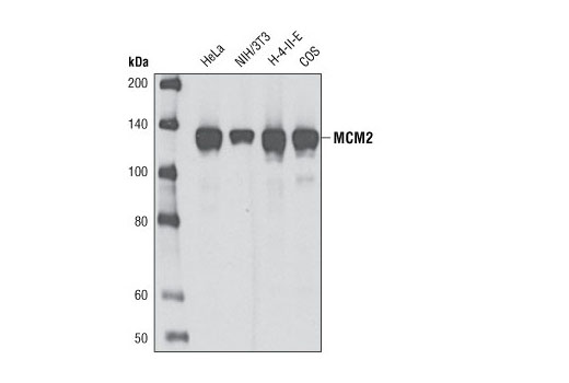 MCM2 (D7G11) XP Rabbit mAb