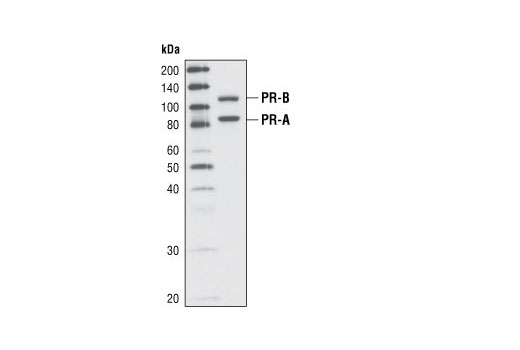 Progesterone Receptor A/B Antibody