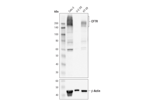CFTR (D6W6L) Rabbit mAb