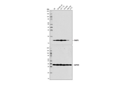 FABP5 (D1A7T) Rabbit mAb