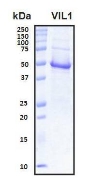 Recombinant Human Villin 1