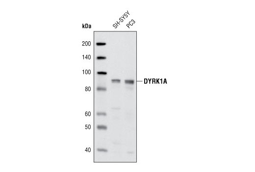 DYRK1A Antibody