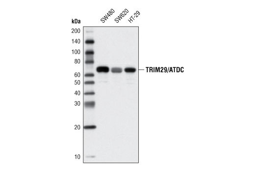 TRIM29/ATDC Antibody