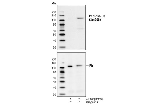 Phospho-Rb (Ser608) Antibody