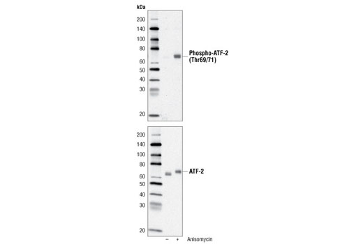 ATF-2 Control Cell Extracts