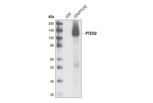 PTCH2 (G1191) Antibody