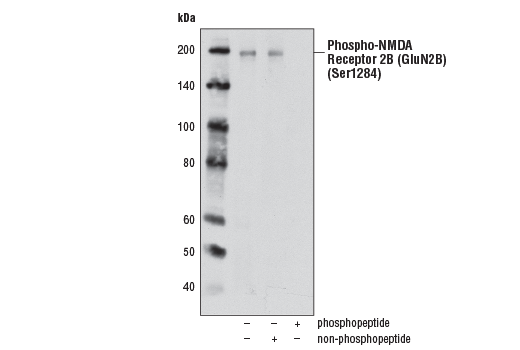 Phospho-NMDA Receptor 2B (GluN2B) (Ser1284) Antibody