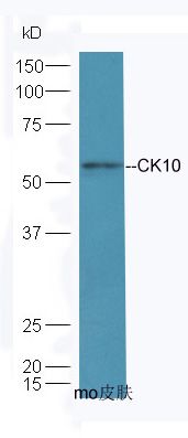 细胞角蛋白10抗体