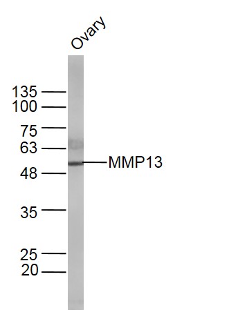 基质金属蛋白酶13抗体