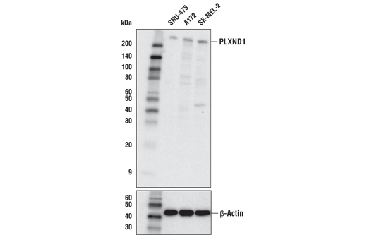 PLXND1 Antibody