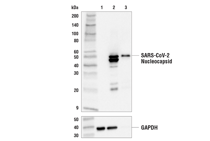 SARS-CoV-2 Nucleocapsid Protein (E8R1L) Mouse mAb