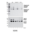 Phospho-p70 S6 Kinase (Thr389) (108D2) Rabbit mAb