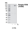 Phospho-PERK (Thr980) (16F8) Rabbit mAb