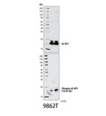 mTOR Substrates Antibody Sampler Kit