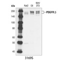 PDGF Receptor β (28E1) Rabbit mAb