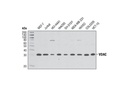 VDAC (D73D12) Rabbit mAb