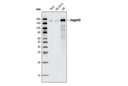 Notch Receptor Interaction Antibody Sampler Kit