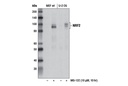 Sequestosome Signaling Antibody Sampler Kit