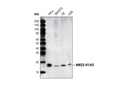 NME1/NDKA (D98) Antibody
