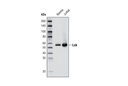 Lck (D88) XP Rabbit mAb