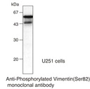 Anti-Phosphorylated Vimentin (Ser82) mAb