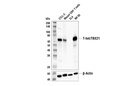 T-bet/TBX21 (E4I2K) Rabbit Monoclonal Antibody